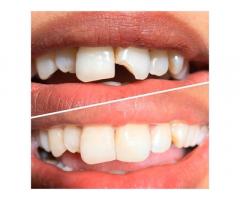 عيادة الفردوس الرائده للتجميل و طب وجراحه الفم والاسنان - عين زارة