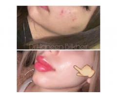 د.حنين بالخير Dr.Haneen Bilkheir طبيبة جراحة تجميل الوجه والفكين والعلاج بالليزر