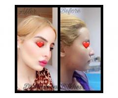 د.حنين بالخير Dr.Haneen Bilkheir طبيبة جراحة تجميل الوجه والفكين والعلاج بالليزر