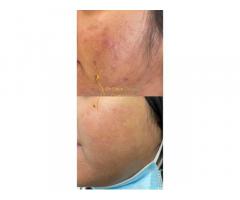 د. ايمان رحومة طبيبة جلدية و تجميل Dr. Eman Orhoma CosmoDerma