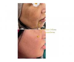 د. ايمان رحومة طبيبة جلدية و تجميل Dr. Eman Orhoma CosmoDerma