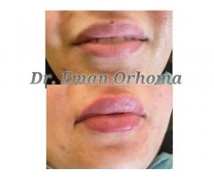 د. ايمان رحومة طبيبة جلدية و تجميل Dr. Eman Orhoma CosmoDerma