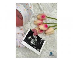 مشفى المواصفات