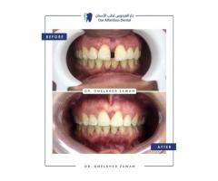 مركز دار الفردوس لطب الاسنان